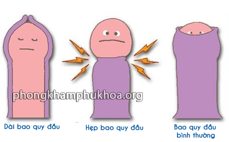Bao quy đầu là gì? Bao quy đầu là gì?
