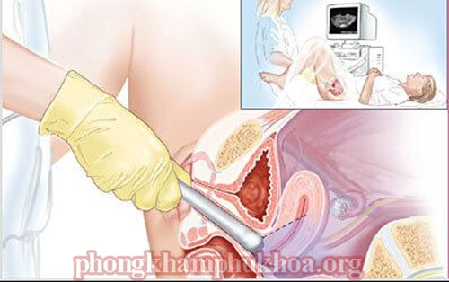 dieu-tri-viem-am-dao-bang-ky-thuat-ozone