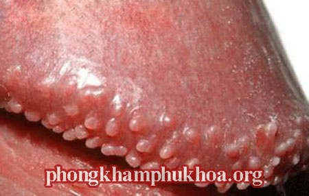 hinh-anh-gai-sinh-duc-nam-gioi