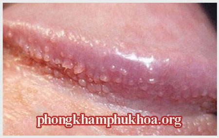 hinh-anh-gai-sinh-duc-o-nam-gioi(2)
