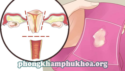 huyet-trang-ra-nhieu-co-bi-sao-khong