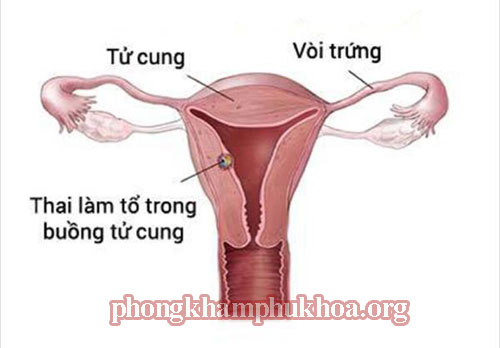 sau-quan-he-bao-lau-thi-thai-lam-to-trong-tu-cung