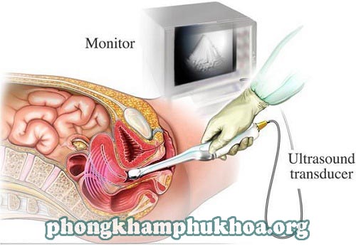 sieu-am-dau-do-am-dao